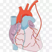 冠状动脉旁路手术心肌梗死心脏学冠状动脉解剖