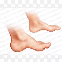 足趾踝足肢端肥大症