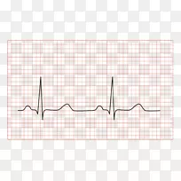 心电，心电图，心脏病学，心脏医学.心脏