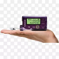 胰岛素泵型糖尿病小型Med范式1型糖尿病-胰岛素治疗
