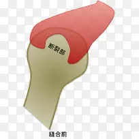 肩关节肩袖肱骨肩胛骨