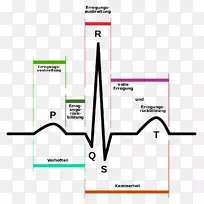 心电图心脏心律失常信号处理房颤-3导联心电图