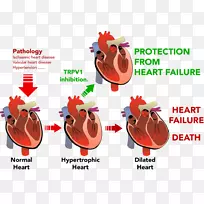 心衰，心室肥厚，心血管疾病-心脏