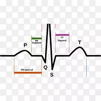 心电心率脉搏图
