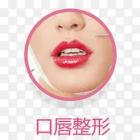 口唇整形实物展示图