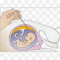 胚胎里的胎儿