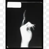 伸出一根手指的手部x光图像
