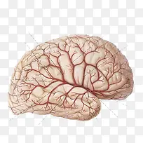 脑血管分析图