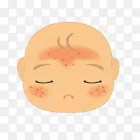 卡通婴儿湿疹