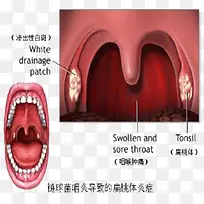 手绘喉咙细节图