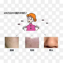 别挤痘痘