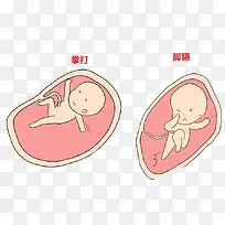 胎儿踢肚子漫画