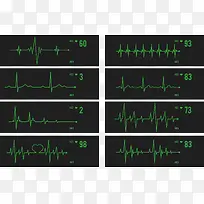 心电监护仪心跳检测